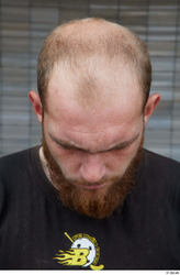 Head Hair Man White Casual Average Bearded Bald Street photo references